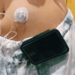 Retiran la ayuda a una menor dependiente con diabetes y discapacidad de San Sebastián de los Reyes al cumplir 14 años