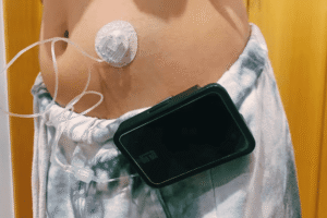 Menor con diabetes y discapacidad en San Sebastián de los Reyes tras retirada de ayuda CUME por cumplir 14 años